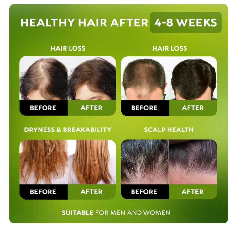 Pure Batana Oil – Expert Formula for Regrowth & Protection